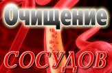 Очищение сосудов от холестериновых бляшек без лекарств
