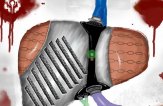 Искусственная печень — создание российских ученых
