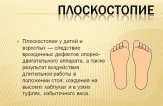 Профилактика плоскостопия у взрослых