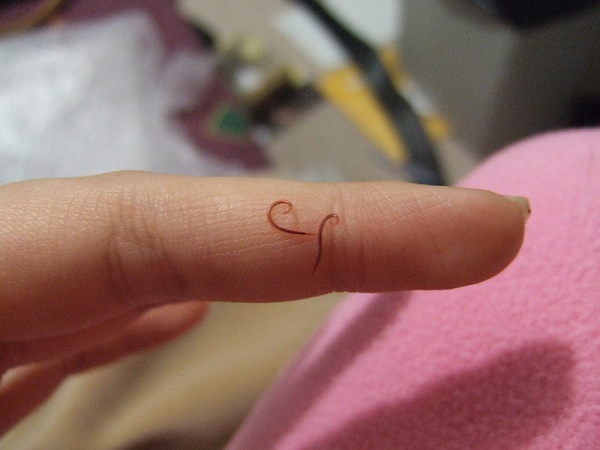 Chervy nematody