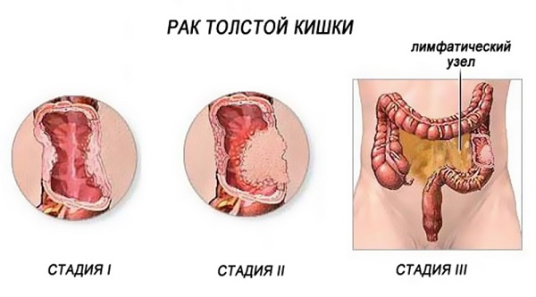 Rak2