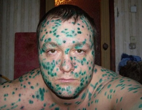 Лицо в зеленке