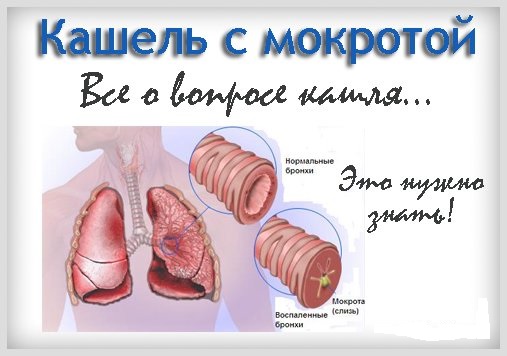 Пичины кашля с мокротой