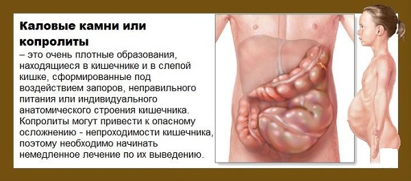 Как очистить кишечник от каловых масс