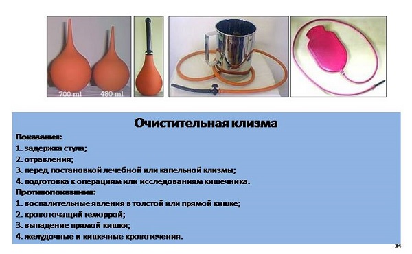 Klizma