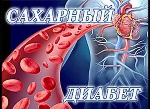 Диабет