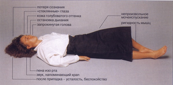 Priznaky