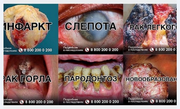 Болезни от курения
