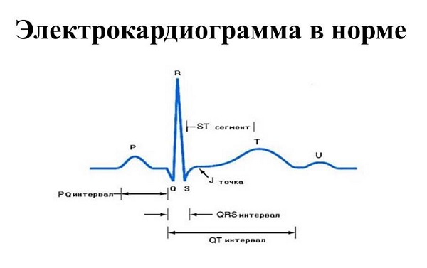 Электрокардиограмма в норме