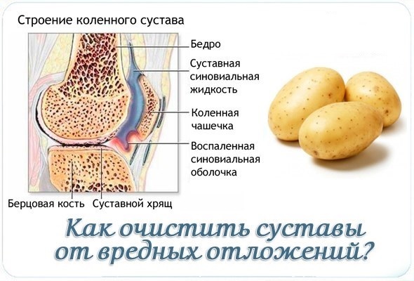 Как почистить суставы