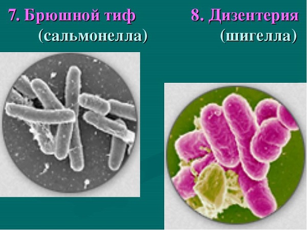 Сальмонелла-возбудитель брюшного тифа