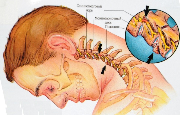 Устройство шеи