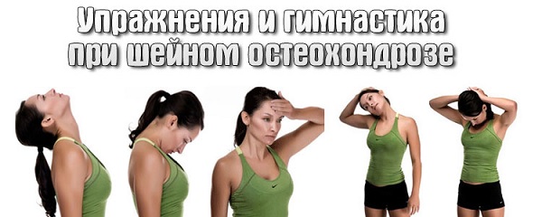 Упражнения при остеохондрозе шеи