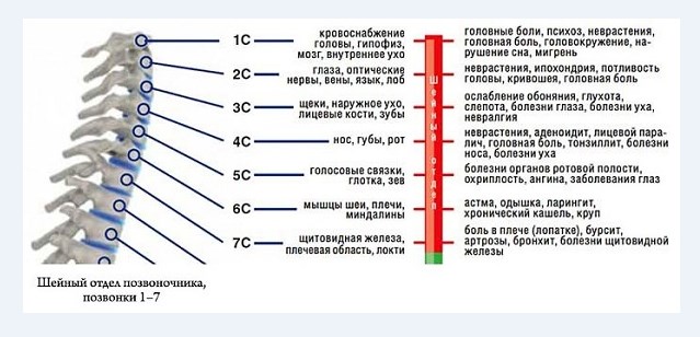 Причины болей от шейного остеохондроза