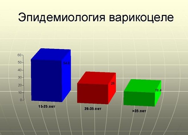 Эпидемиология варикоцеле