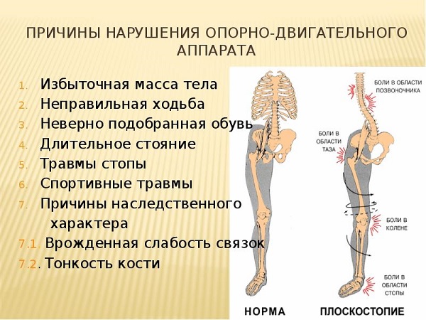 Причины нарушения опрно-двигательной системы 
