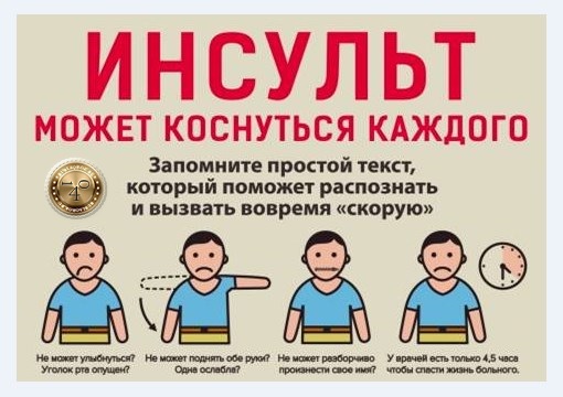 признаки инсульта