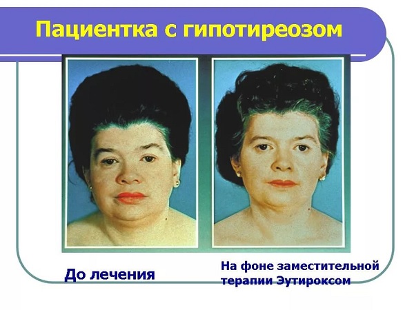 пациентка