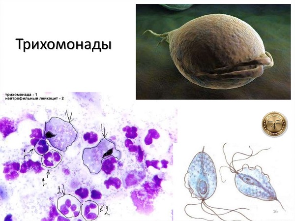 трихомонады в организме человека