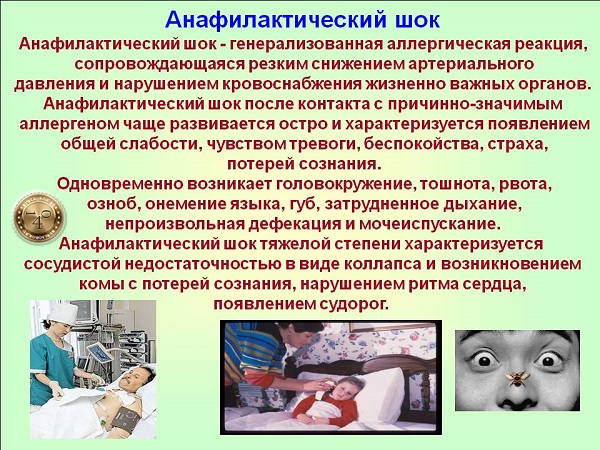 анафилактический шок что такое
