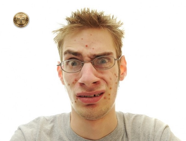 смущение от угрей