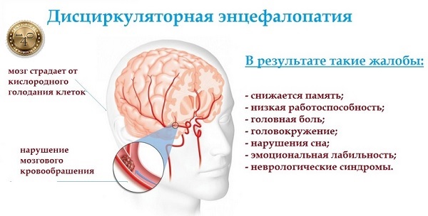 заболевание энцефалопатия