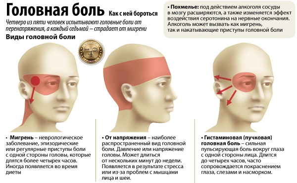 виды головной боли