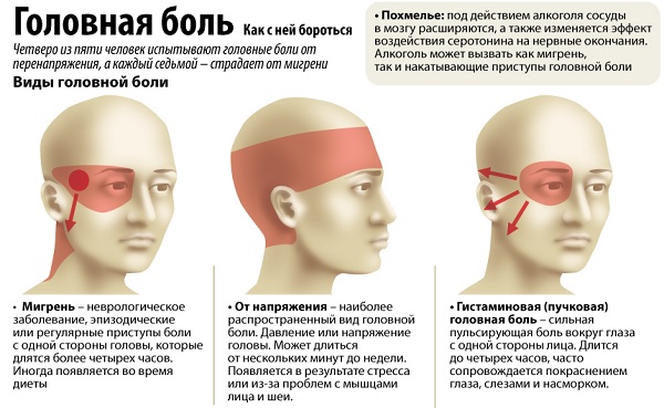 виды головной боли