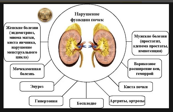 нарушение работы почек
