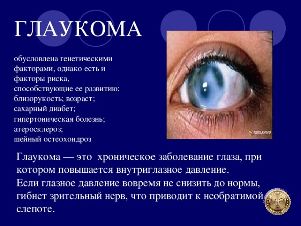 глаукома