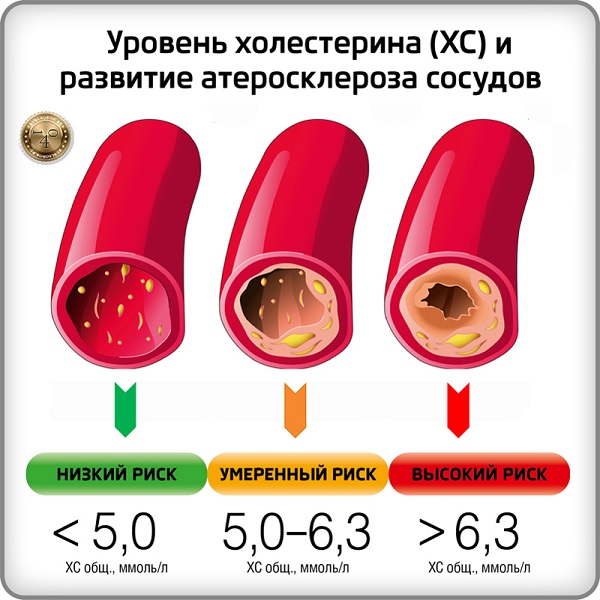 уровень холестерина