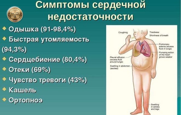 симптомы сердечной недостаточности