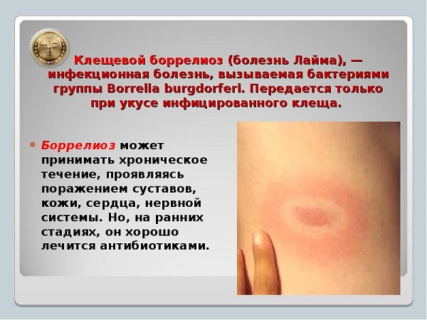 клещевой боррелиоз