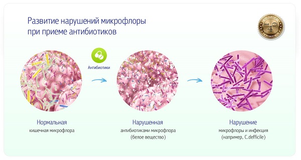 нарушение микрофлоры