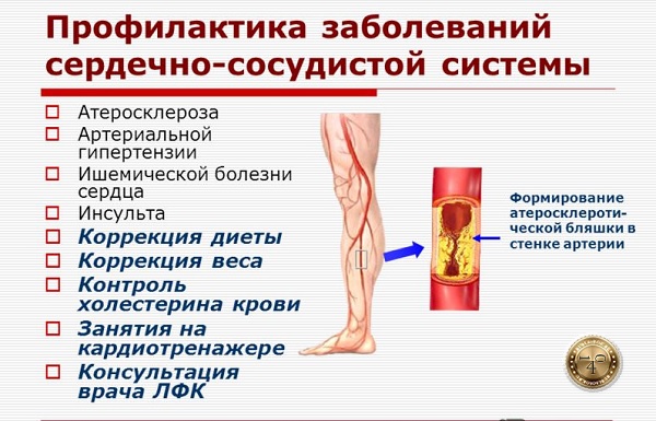 профилактика сердечно-сосудистых заболеваний