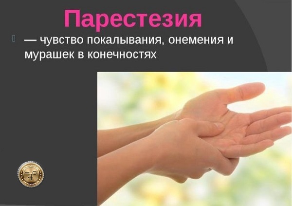 парестезия