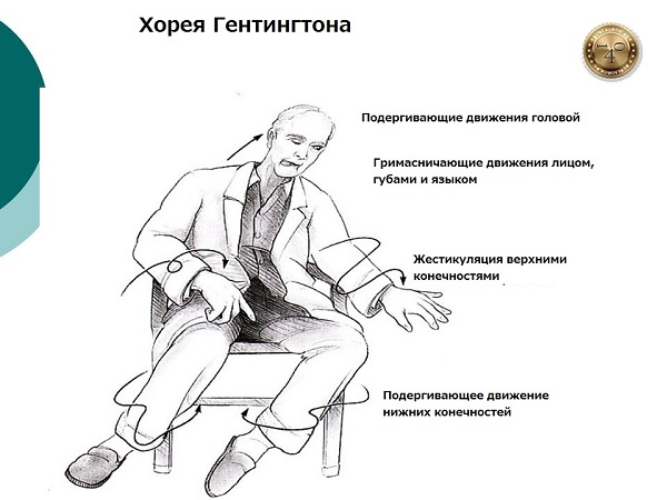 хорея Гетингтона
